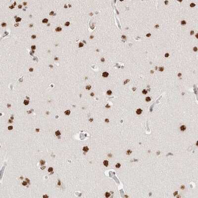Immunohistochemistry-Paraffin: ZNF282 Antibody [NBP1-81653] - Staining of human cerebral cortex shows strong nuclear positivity in neurons.