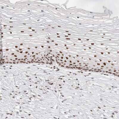 Immunohistochemistry-Paraffin: ZNF282 Antibody [NBP1-81653] - Staining of human cervix shows strong nuclear positivity in squamous epithelial cells.