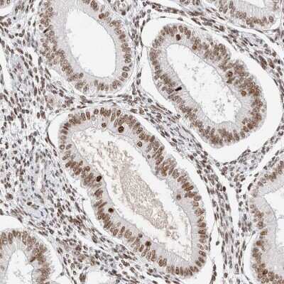 Immunohistochemistry-Paraffin: ZNF282 Antibody [NBP1-81653] - Staining of human endometrium shows moderate nuclear positivity in glandular cells.