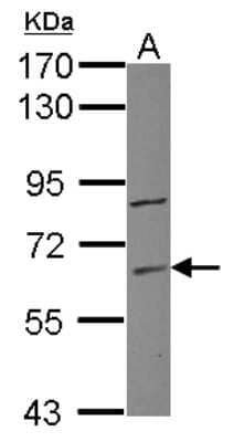 Western Blot: ZNF282 Antibody [NBP2-20985] - Sample (30 ug of whole cell lysate) A: Raji 7. 5% SDS PAGE gel, diluted at 1:1000.
