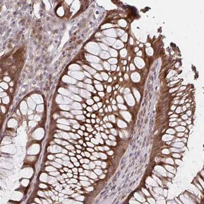 Immunohistochemistry: ZNF285A Antibody [NBP2-33454] - Staining of human rectum shows strong cytoplasmic and membranous positivity in glandular cells.