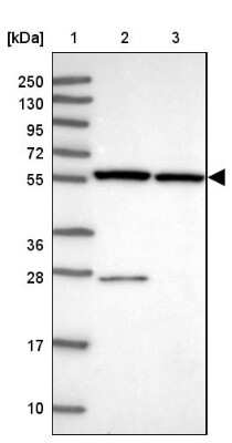 Western Blot: ZNF285A Antibody [NBP2-33454] - Lane 1: Marker  [kDa] 250, 130, 95, 72, 55, 36, 28, 17, 10.  Lane 2: Human cell line RT-4.  Lane 3: Human cell line U-251MG sp