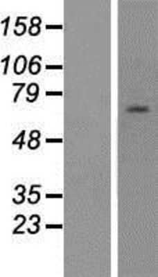 Western Blot: ZNF285A Overexpression Lysate (Adult Normal) [NBP2-05393] Left-Empty vector transfected control cell lysate (HEK293 cell lysate); Right -Over-expression Lysate for ZNF285A.