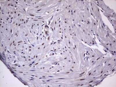 Immunohistochemistry: ZNF286 Antibody (7D2) [NBP2-46432] - Analysis of Carcinoma of Human kidney tissue.