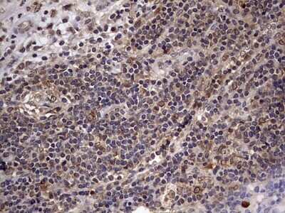Immunohistochemistry: ZNF286 Antibody (7D2) [NBP2-46432] - Analysis of Human lymph node tissue.