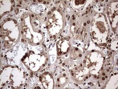 Immunohistochemistry: ZNF286 Antibody (OTI7D2) - Azide and BSA Free [NBP2-74935] - Analysis of Human Kidney tissue.