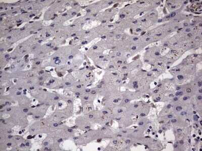 Immunohistochemistry: ZNF286 Antibody (OTI7D2) - Azide and BSA Free [NBP2-74935] - Analysis of Human liver tissue.