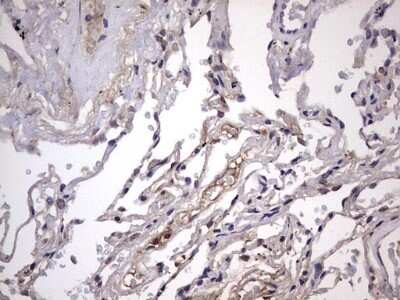 Immunohistochemistry: ZNF286 Antibody (OTI7D2) - Azide and BSA Free [NBP2-74935] - Analysis of Human lung tissue.