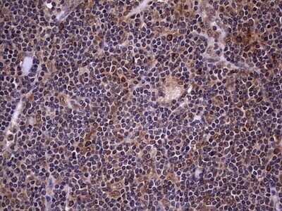 Immunohistochemistry: ZNF286 Antibody (OTI7D2) - Azide and BSA Free [NBP2-74935] - Analysis of Human lymphoma tissue.