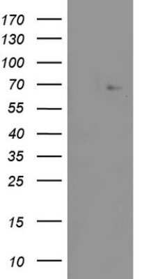 Western Blot: ZNF286 Antibody (OTI7D2) - Azide and BSA Free [NBP2-74935] - Analysis of HEK293T cells were transfected with the pCMV6-ENTRY control (Left lane) or pCMV6-ENTRY ZNF286A.