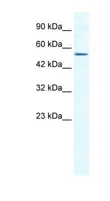 Western Blot: ZNF286 Antibody [NBP1-80119] - Titration: 0.2-1 ug/ml, Positive Control: HepG2 cell lysate.