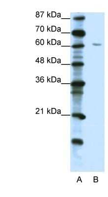 Western Blot: ZNF286 Antibody [NBP1-80345] - Jurkat cell lysate, concentration 1.25ug/ml.