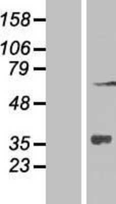 Western Blot: ZNF286 Overexpression Lysate (Adult Normal) [NBP2-06607] Left-Empty vector transfected control cell lysate (HEK293 cell lysate); Right -Over-expression Lysate for ZNF286.