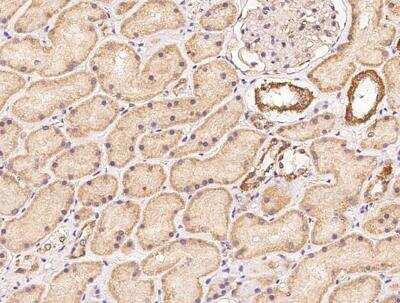 Immunohistochemistry-Paraffin: ZNF292 Antibody [NBP3-12714] - Staining of human ZNF292 in human kidney with rabbit polyclonal antibody at 1:100 dilution.
