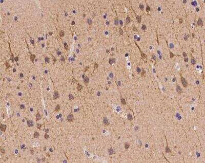 Immunohistochemistry-Paraffin: ZNF292 Antibody [NBP3-12714] - Staining of human ZNF292 in human brain with rabbit polyclonal antibody at 1:100 dilution.