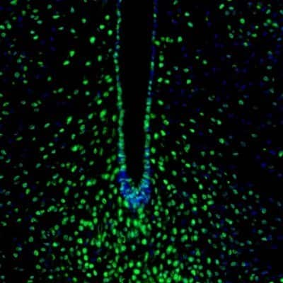 Immunocytochemistry/Immunofluorescence: ZNF3 Antibody [NBP1-89329] - Staining of mouse hypothalamus shows nuclear immunoreactivity in the neurons in the arcuate nucleus.