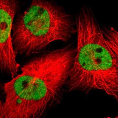 Immunocytochemistry/Immunofluorescence: ZNF3 Antibody [NBP1-89329] - Immunofluorescent staining of human cell line U-251 MG shows localization to nucleoplasm.