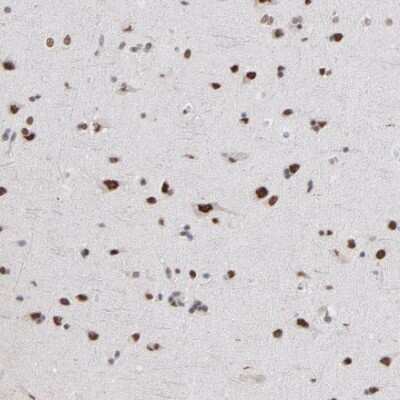 Immunohistochemistry-Paraffin: ZNF3 Antibody [NBP1-89329] - Staining of human cerebral cortex shows strong nuclear immunoreactivity in neurons.