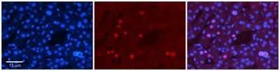 Immunohistochemistry-Paraffin: ZNF3 Antibody [NBP2-86471] - Formalin Fixed Paraffin Embedded Tissue: Human Adult Liver. Observed Staining: Nuclear in hepatocytes, moderate signal, low tissue distribution. Primary Antibody Concentration: 1:100.