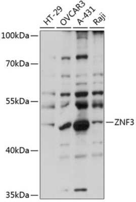 Western Blot: ZNF3 Antibody [NBP2-93420] - Analysis of extracts of various cell lines, using ZNF3 at 1:1000 dilution. Secondary antibody: HRP Goat Anti-Rabbit IgG (H+L) at 1:10000 dilution. Lysates/proteins: 25ug per lane. Blocking buffer: 3% nonfat dry milk in TBST. Detection: ECL Basic Kit . Exposure time: 30s.