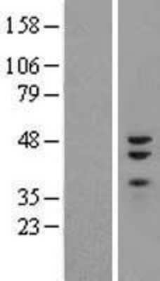 Western Blot ZNF3 Overexpression Lysate