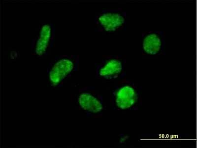 Immunocytochemistry/Immunofluorescence: ZNF302 Antibody [H00055900-B01P] - Analysis of purified antibody to ZNF302 on HeLa cell. (antibody concentration 10 ug/ml)
