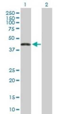 Western Blot: ZNF302 Antibody [H00055900-B01P] - Analysis of ZNF302 expression in transfected 293T cell line by ZNF302 polyclonal antibody.  Lane 1: ZNF302 transfected lysate(43.89 KDa). Lane 2: Non-transfected lysate.