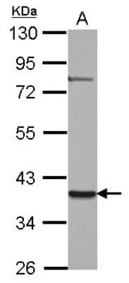 Western Blot: ZNF302 Antibody [NBP2-15170] - Sample (30 ug of whole cell lysate) A: NT2D1 10% SDS PAGE, antibody diluted at 1:2000.