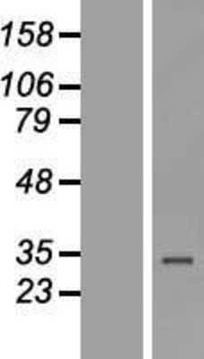 Western Blot: ZNF302 Overexpression Lysate (Adult Normal) [NBL1-18113] Left-Empty vector transfected control cell lysate (HEK293 cell lysate); Right -Over-expression Lysate for ZNF302.