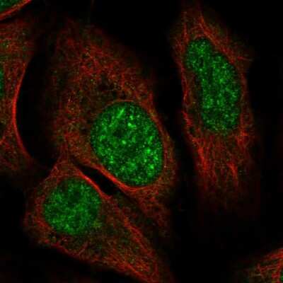 Immunocytochemistry/Immunofluorescence: ZNF304 Antibody [NBP2-31901] - Staining of human cell line U-2 OS shows localization to nuclear speckles. Antibody staining is shown in green.