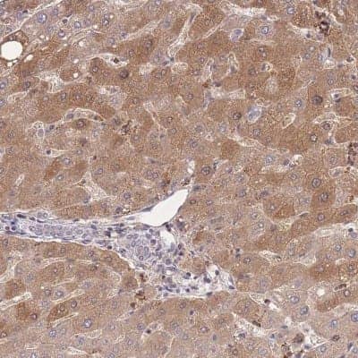 Immunohistochemistry-Paraffin: ZNF304 Antibody [NBP2-31901] - Staining of human liver shows moderate cytoplasmic positivity in hepatocytes.