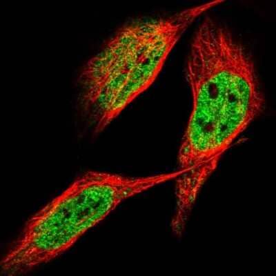 Immunocytochemistry/ Immunofluorescence ZNF31 Antibody - BSA Free