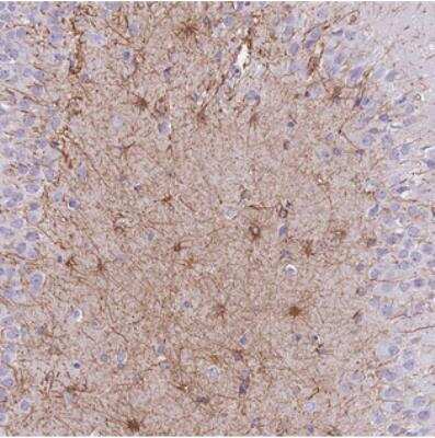 Immunohistochemistry: ZNF311 Antibody [NBP2-31031] - Staining of human hippocampus shows strong cytoplasmic positivity in astrocytes.