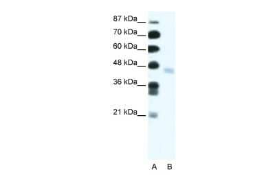 Western Blot: ZNF312 Antibody [NBP2-84354] - WB Suggested Anti-ZNF312 Antibody Titration: 2.5ug/ml. Positive Control: Jurkat cell lysate