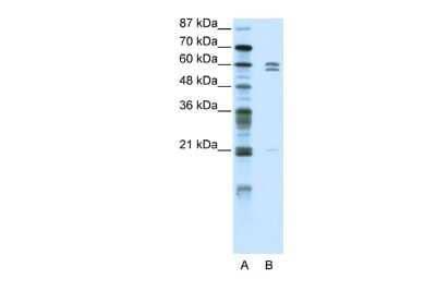 Western Blot: ZNF312 Antibody [NBP2-84355] - WB Suggested Anti-ZNF312 Antibody Titration: 5.0ug/ml. ELISA Titer: 1:1562500. Positive Control: HepG2 cell lysateFEZF2 is supported by BioGPS gene expression data to be expressed in HepG2