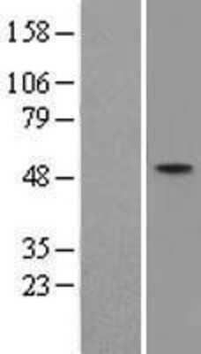 Western Blot: ZNF312 Overexpression Lysate (Adult Normal) [NBL1-10680] Left-Empty vector transfected control cell lysate (HEK293 cell lysate); Right -Over-expression Lysate for ZNF312.