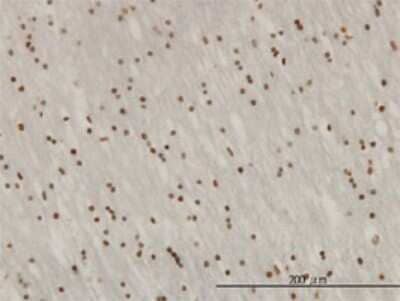 Immunohistochemistry-Paraffin: ZNF313 Antibody (4G3-1A10) [H00055905-M01] - Analysis of monoclonal antibody to ZNF313 on formalin-fixed paraffin-embedded human lateral ventricle wall. Antibody concentration 3 ug/ml.