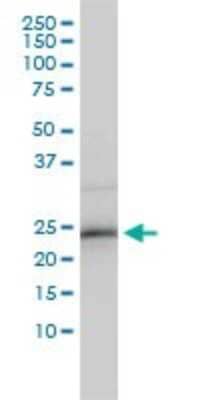 Western Blot: ZNF313 Antibody (4G3-1A10) [H00055905-M01] - ZNF313 monoclonal antibody (M01), clone 4G3-1A10 Analysis of ZNF313 expression in HepG2.