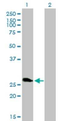 Western Blot: ZNF313 Antibody (4G3-1A10) [H00055905-M01] - Analysis of ZNF313 expression in transfected 293T cell line by ZNF313 monoclonal antibody (M01), clone 4G3-1A10.Lane 1: ZNF313 transfected lysate(25.7 KDa).Lane 2: Non-transfected lysate.