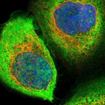 Immunocytochemistry/Immunofluorescence: ZNF313 Antibody [NBP1-87204] - Staining of human cell line A-431 shows localization to plasma membrane & cytosol. Antibody staining is shown in green.