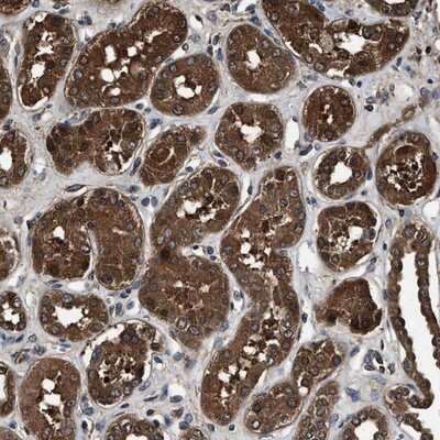 Immunohistochemistry-Paraffin: ZNF313 Antibody [NBP1-87204] - Staining of human kidney shows strong cytoplasmic positivity in cells in tubules.