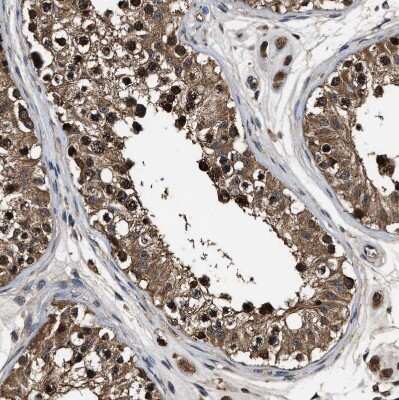 Immunohistochemistry-Paraffin: ZNF313 Antibody [NBP1-87204] - Staining of human testis shows strong cytoplasmic and nuclear positivity in cells in seminiferous ducts.