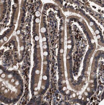 Immunohistochemistry-Paraffin: ZNF313 Antibody [NBP1-87204] - Staining of human duodenum shows moderate cytoplasmic positivity in glandular cells.