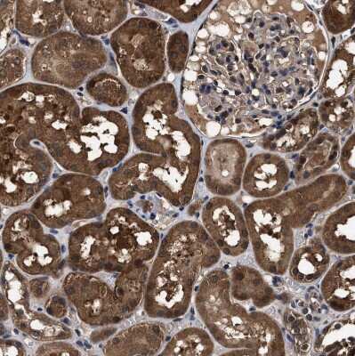 Immunohistochemistry-Paraffin: ZNF313 Antibody [NBP1-87204] - Staining of human kidney shows strong cytoplasmic positivity in cells in tubules.