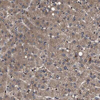 Immunohistochemistry-Paraffin: ZNF313 Antibody [NBP1-87204] - Staining of human liver shows moderate cytoplasmic positivity in hepatocytes.