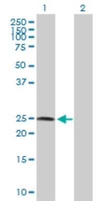 Western Blot: ZNF313 Antibody [H00055905-D01P] - Analysis of RNF114 expression in transfected 293T cell line by RNF114 polyclonal antibody.Lane 1: ZNF313 transfected lysate(25.70 KDa).Lane 2: Non-transfected lysate.