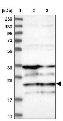 Western Blot: ZNF313 Antibody [NBP1-87204] - Lane 1: Marker  [kDa] 230, 130, 95, 72, 56, 36, 28, 17, 11.  Lane 2: Human cell line RT-4.  Lane 3: Human cell line U-251MG sp