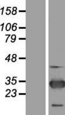 Western Blot ZNF313 Overexpression Lysate