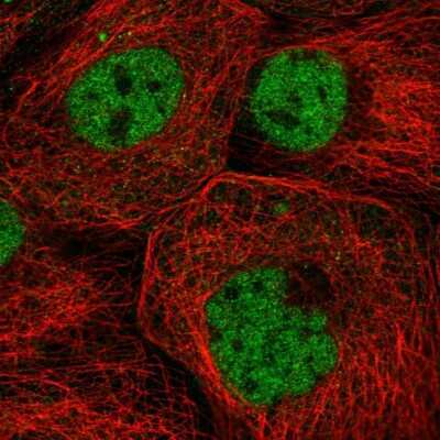 Immunocytochemistry/Immunofluorescence: ZNF317 Antibody [NBP2-58269] - Staining of human cell line A-431 shows localization to nucleoplasm.