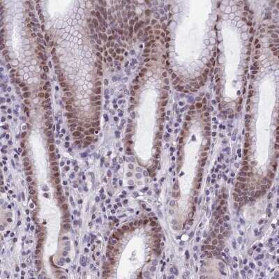 Immunohistochemistry-Paraffin ZNF317 Antibody - BSA Free